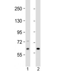 Western blot testing of human 1) Jurkat and 2) human fetal kidney lysate with EPHX2 antibody at 1:20