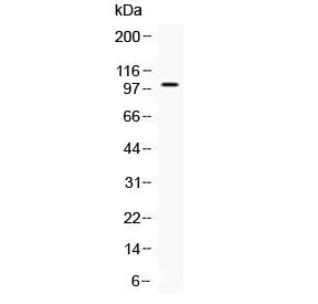 NARG1 Antibody / NAA15