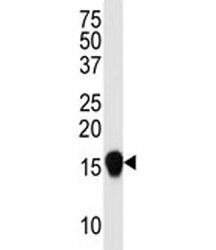 Western blot analysis of SUMO4 antibody (V55 Mutant) in HepG2 lysate. Observed molecular weight: 11-