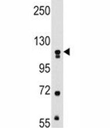 MUSK Antibody