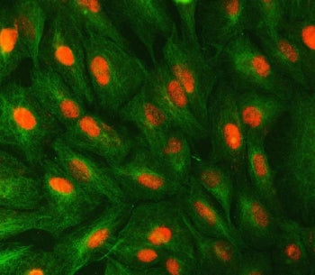 STX6 Antibody / Syntaxin 6