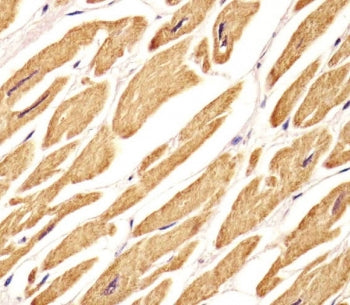 IHC testing of FFPE human heart tissue with VLDL Receptor antibody. HIER: steam section in pH6 citra