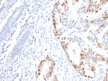 p53 Antibody / TP53 N-Terminal Region