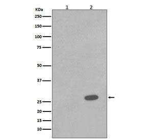Western blot testing of lysate from human A431 cells 1) untreated or 2) treated with Anisomycin, wit