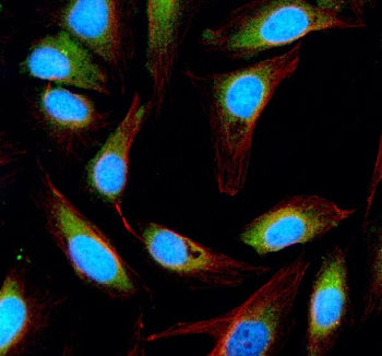 Immunofluorescent staining of ESD using anti-ESD antibody (green) and anti-Beta Tubulin antibody (re