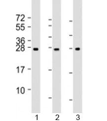 NT5M Antibody