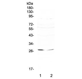 RNF186 Antibody