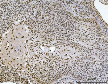 Ataxin 1 Antibody / ATXN1