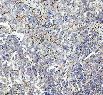 IHC analysis of GIMAP4 using anti-GIMAP4 antibody. GIMAP4 was detected in a paraffin-embedded sectio