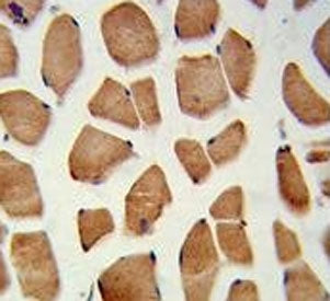 IHC testing of FFPE human skeletal muscle tissue with PHYH antibody. HIER: steam section in pH6 citr