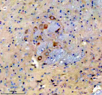 NCR2 Antibody / Natural cytotoxicity triggering receptor 2, 100ul