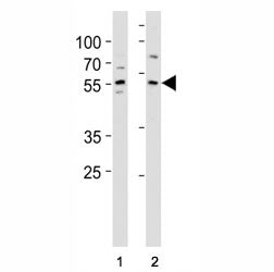 KLF4 antibody western blot analysis in (1) A431 and (2) MCF-7 lysate. Predicted molecular weight: 50
