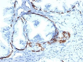 Cytokeratin 14 Antibody / CK14 / KRT14