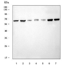 Western blot testing of 1) human HeLa, 2) human 293T, 3) human K562, 4) rat liver, 5) rat pancreas,