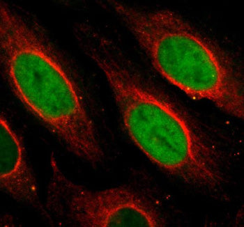 Immunofluorescent staining of NUSAP1 using anti-NUSAP1 antibody (green) and anti-Beta Tubulin antibo