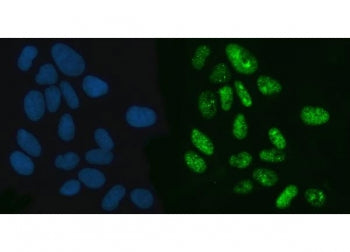 Immunofluorescent staining of FFPE human U-2 OS cells with XPO5 antibody (green) and DAPI nuclear st