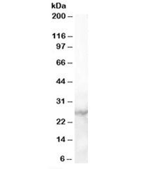 Western blot testing of human heart lysate with MBL2 antibody at 1ug/ml. Predicted molecular weight: