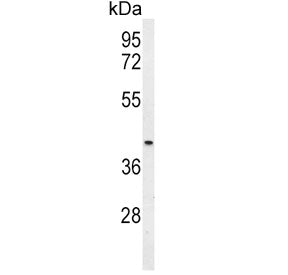 Mu-type Opioid Receptor Antibody / OPRM1