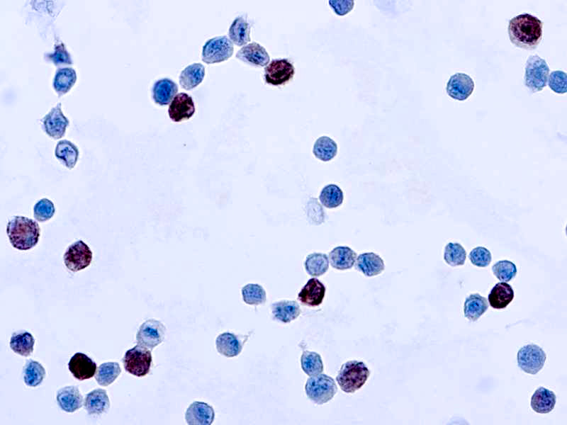 Adenovirus