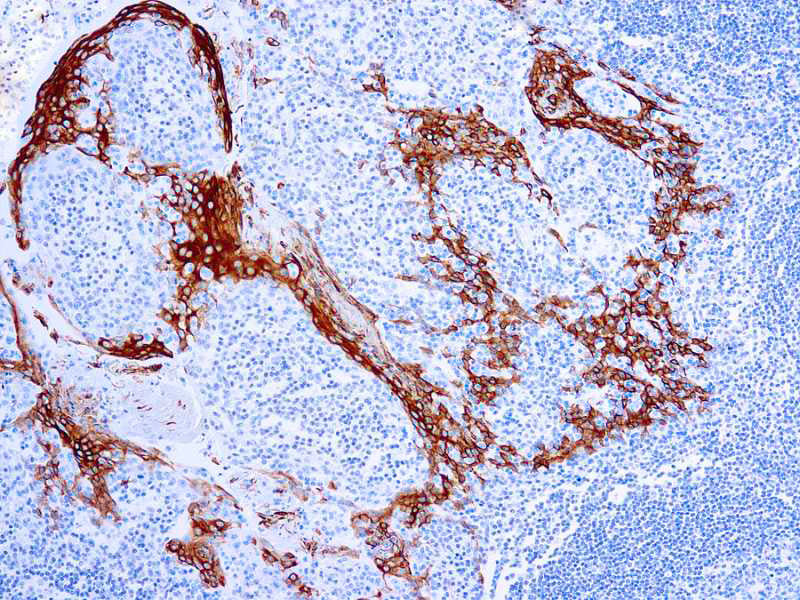 Cytokeratin 16