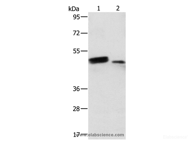 Western Blot analysis of Human liver cancer and normal liver tissue using RARB Polyclonal Antibody at dilution of 1:500
