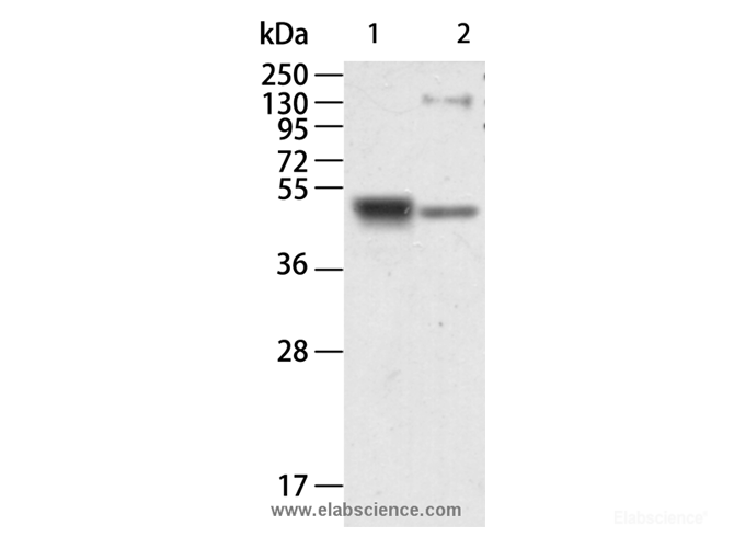 Western Blot analysis of Human kidney and Mouse brain tissue using RAGE Polyclonal Antibody at dilution of 1:750