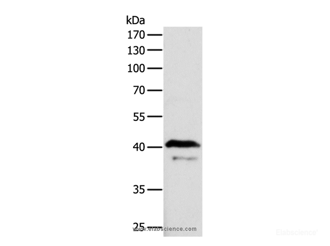 Western Blot analysis of Mouse brain tissue using ADAP1 Polyclonal Antibody at dilution of 1:500