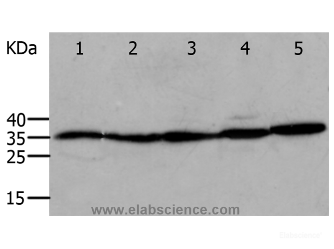 Western Blot analysis of Mouse eyes and heart, Human cervical cancer tissue, OP9 and RAW264.7 cell using ANXA5 Polyclonal Antibody at dilution of 1:750