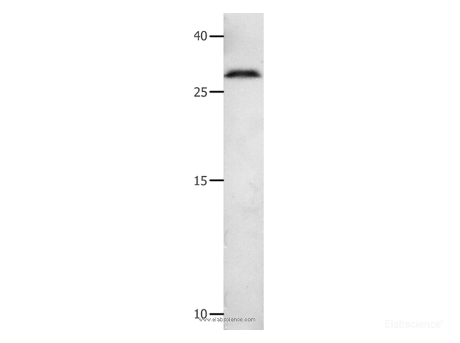 Western Blot analysis of 231 cell using MMP7 Polyclonal Antibody at dilution of 1:600