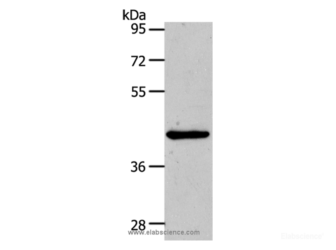 Western Blot analysis of Hela cell using MMP13 Polyclonal Antibody at dilution of 1:500