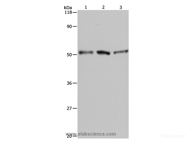 Western Blot analysis of A549, Hela and 293T cell using BAG5 Polyclonal Antibody at dilution of 1:500