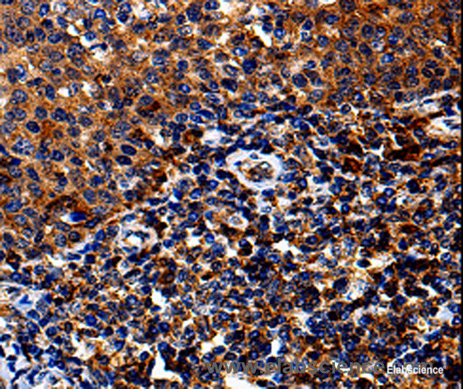 Immunohistochemistry of paraffin-embedded Human tosil tissue using IL13RA1 Polyclonal Antibody at dilution 1:50