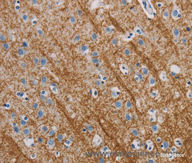 Immunohistochemistry of paraffin-embedded Human brain tissue using ABL1 Polyclonal Antibody at dilution 1:40