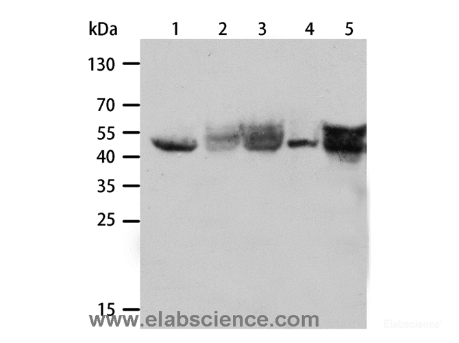 Western Blot analysis of A431, Hela and Lovo cell, Human fetal lung and adult liver tissue using CK-19 Polyclonal Antibody at dilution of 1:1000