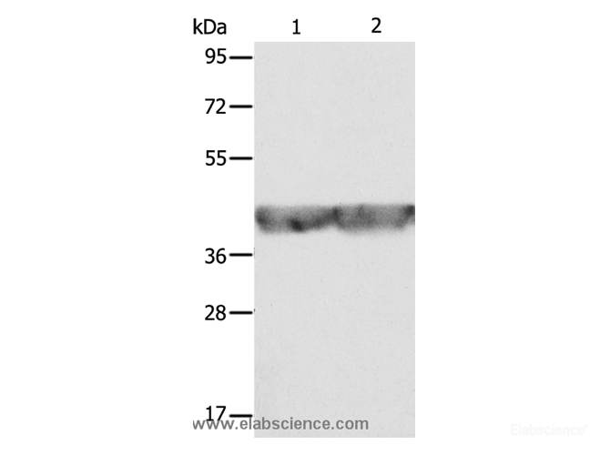 Western Blot analysis of A549 and hela cell using ALDOA Polyclonal Antibody at dilution of 1:500