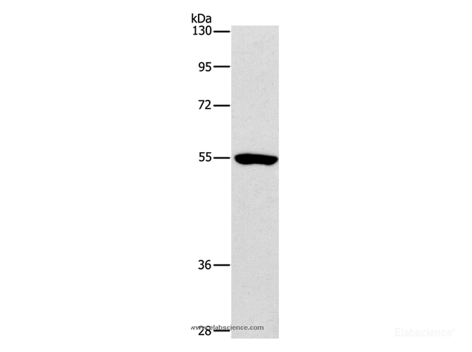 Western Blot analysis of Mouse kidney tissue using ANGPT2 Polyclonal Antibody at dilution of 1:800