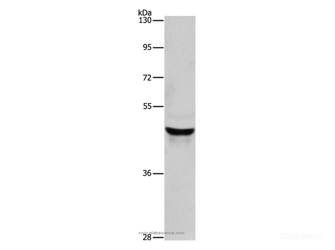 Western Blot analysis of Lovo cell using KRT40 Polyclonal Antibody at dilution of 1:950