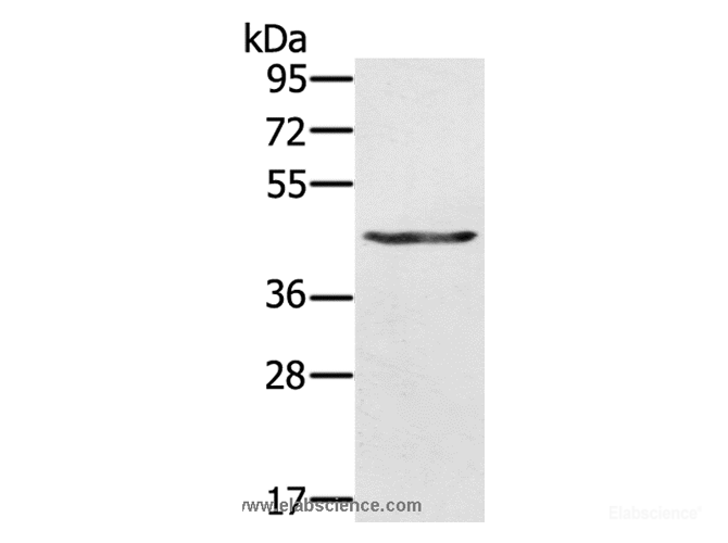 Western Blot analysis of A549 cell using KRT31 Polyclonal Antibody at dilution of 1:500