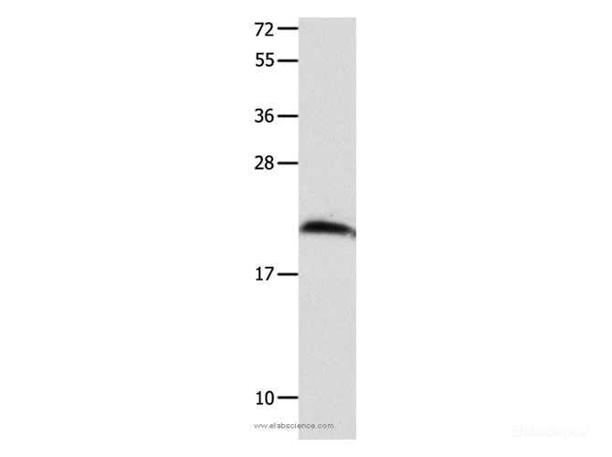 Western Blot analysis of Mouse brain tissue using FGF12 Polyclonal Antibody at dilution of 1:700