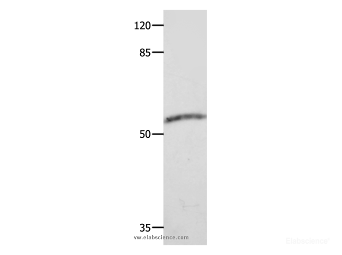 Western Blot analysis of Human fetal muscle tissue using CAP2 Polyclonal Antibody at dilution of 1:600