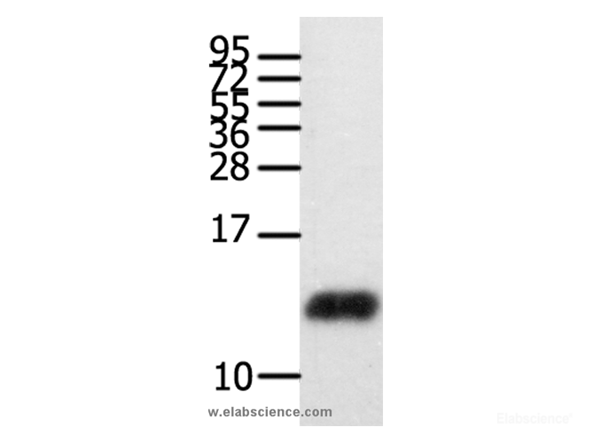 Western Blot analysis of Human brain glioma tissue using CCL28 Polyclonal Antibody at dilution of 1:450
