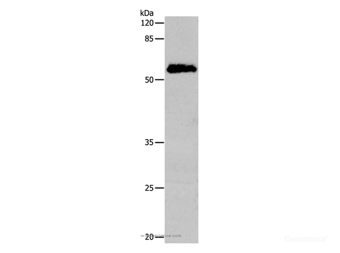 Western Blot analysis of Human cervical cancer tissue using CDC20 Polyclonal Antibody at dilution of 1:600