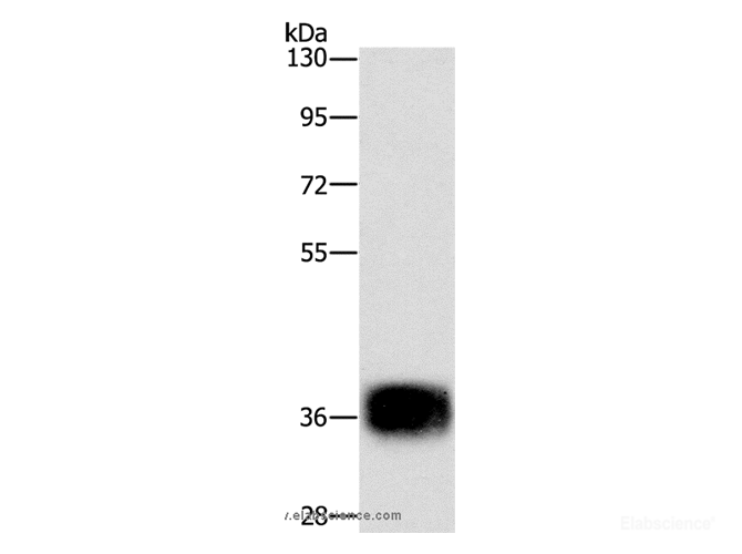 Western Blot analysis of Mouse heart tissue using CEBP epsilon Polyclonal Antibody at dilution of 1:500