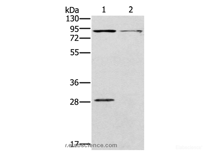 Western Blot analysis of Mouse kidney and brain tissue using CNGA3 Polyclonal Antibody at dilution of 1:500