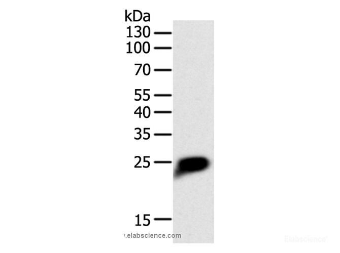 Western Blot analysis of Human liver cancer tissue using CRP Polyclonal Antibody at dilution of 1:1400
