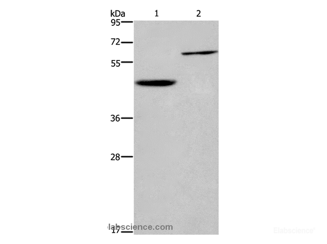Western Blot analysis of Human hepatocellular carcinoma tissue and Jurkat cell using DOK1 Polyclonal Antibody at dilution of 1:450