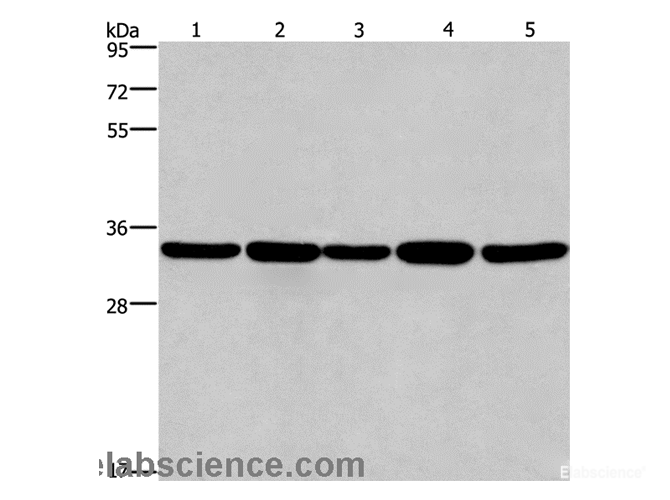 Western Blot analysis of LoVo and A549 cell, Human hepatocellular carcinoma tissue, Jurkat and Hela cell using E2F6 Polyclonal Antibody at dilution of 1:650