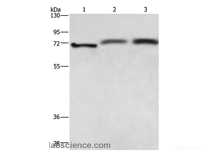 Western Blot analysis of Hela cell, Human fetal brain and hepatocellular carcinoma tissue using RDX Polyclonal Antibody at dilution of 1:700