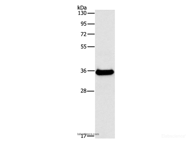 Western Blot analysis of Human fetal liver tissue using FGL1 Polyclonal Antibody at dilution of 1:500