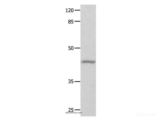 Western Blot analysis of Mouse eyes tissue using GNA11 Polyclonal Antibody at dilution of 1:550